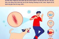 Khuyến cáo phòng chống BỆNH DẠI